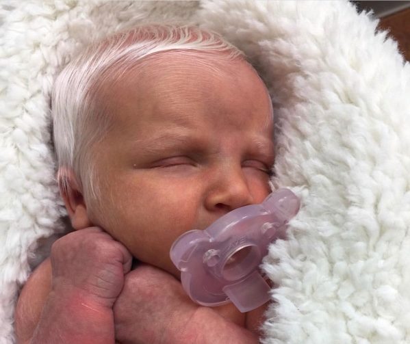 Baby Boy With Head Of White Hair Baffles Everyone Daily Spikes